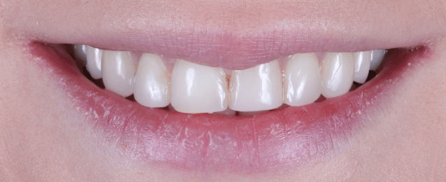 Before - Arte Dental