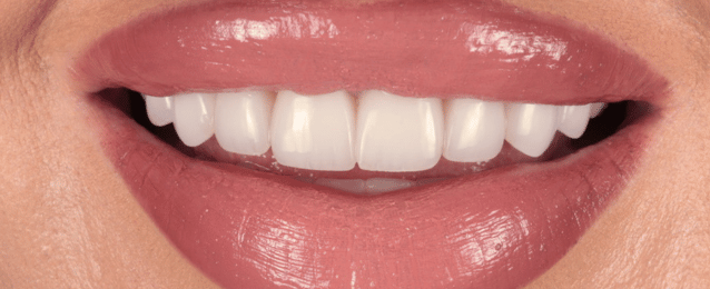 Before - Arte Dental