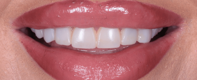After - Arte Dental