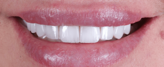 After - Arte Dental
