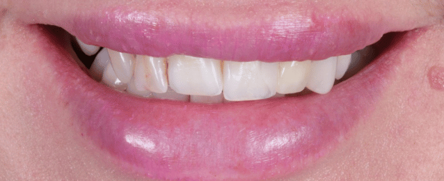 Before - Arte Dental