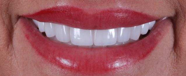 After - Arte Dental