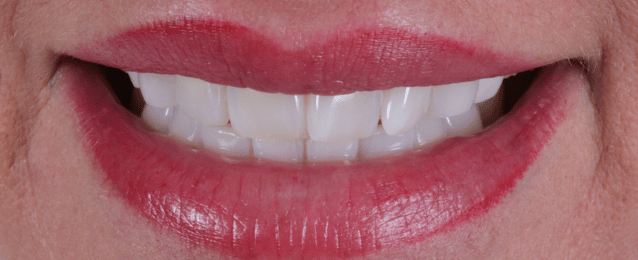 Before - Arte Dental
