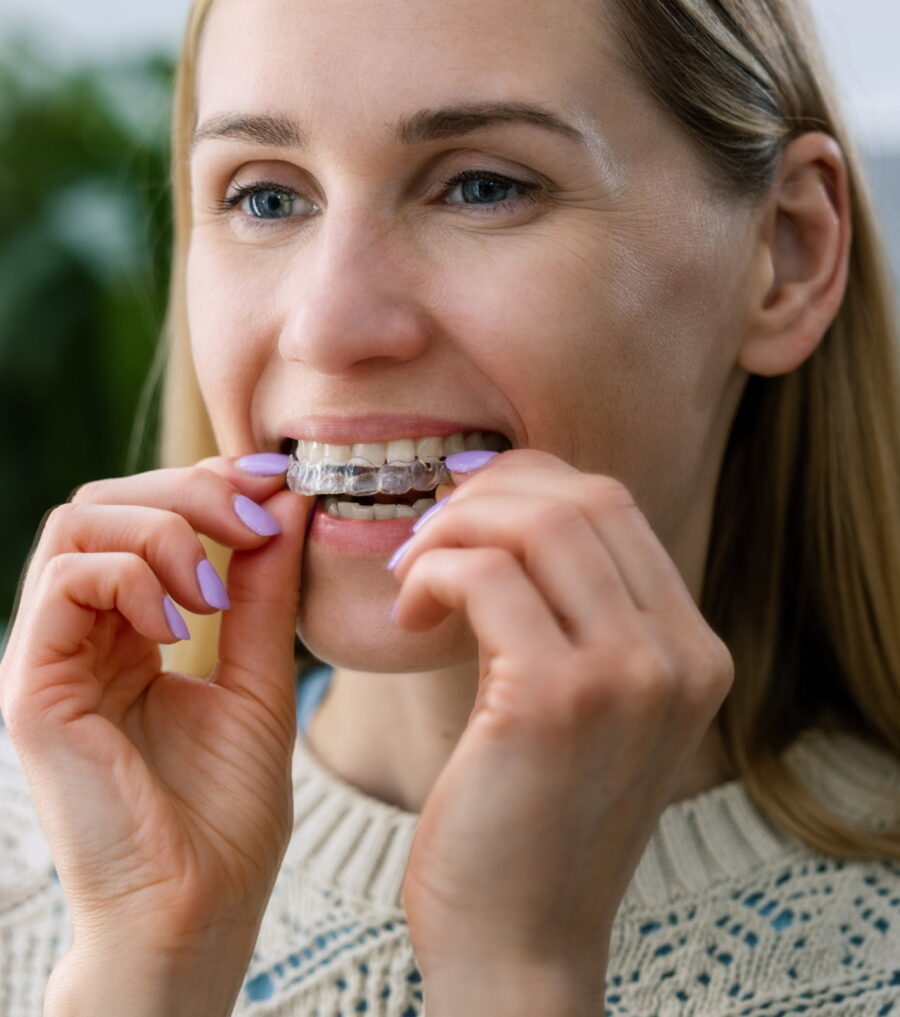 Invisalign